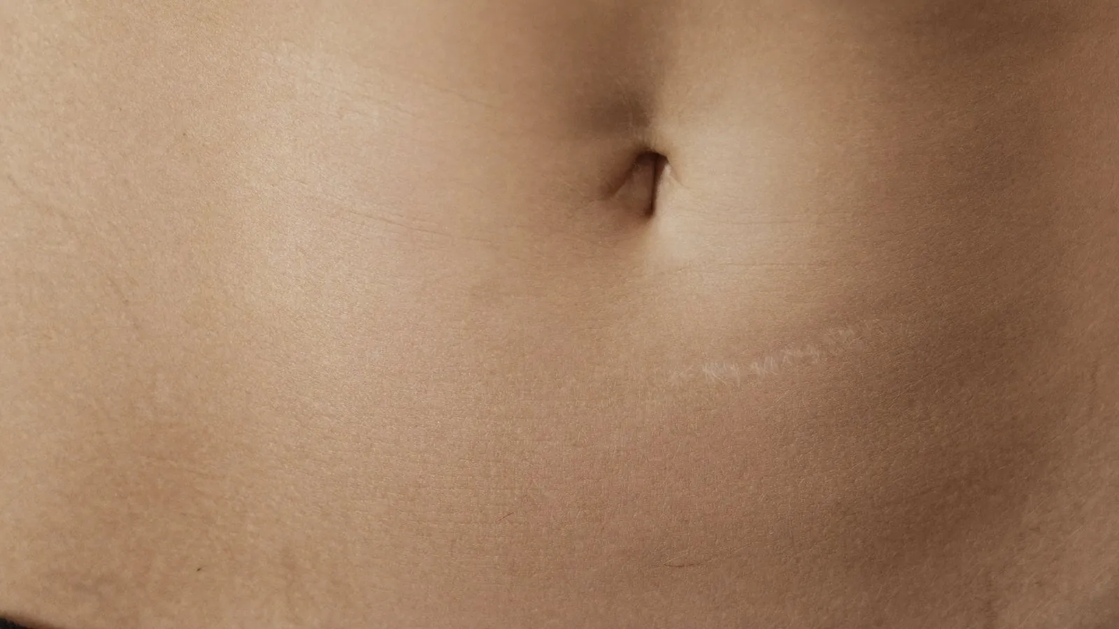 Dr Sin Yong assessing the maturity of a surgical scar before deciding between surgical and non-surgical options