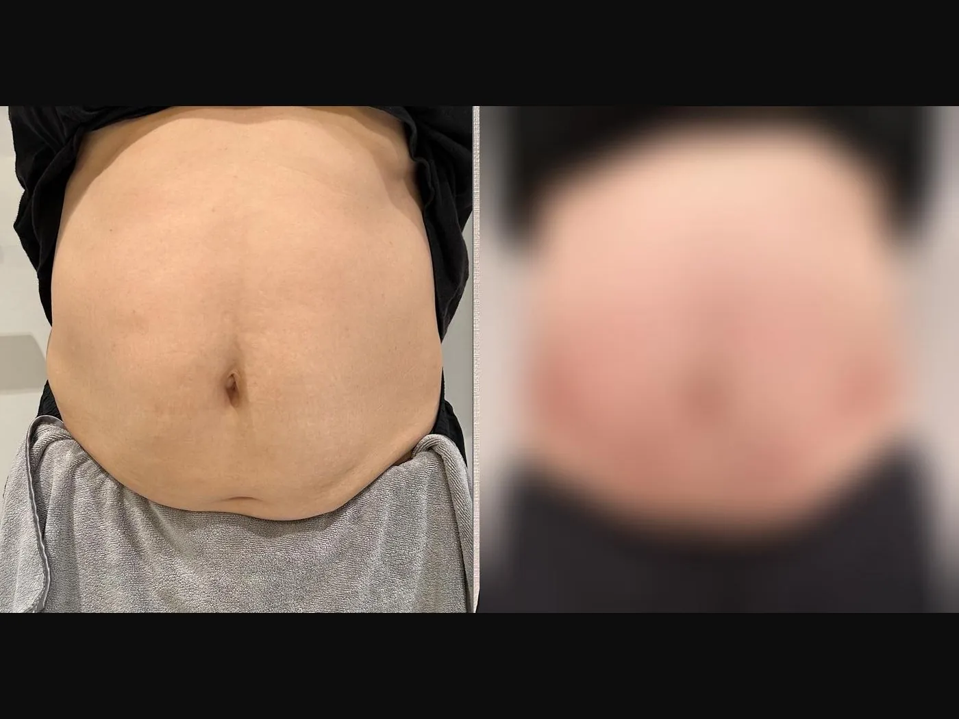 VF Body - Sculpts & Tightens Tummy